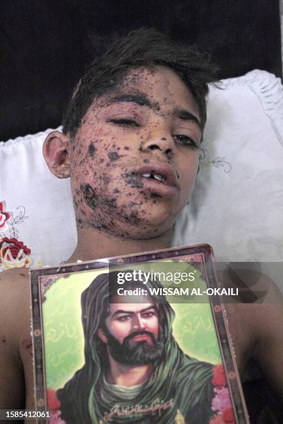 An Iraqi boy named Haidar , injured in a car bomb attack in Baghdad, 06 March 2007, holds a picture of Muslim Shiite Imam Hussein as he recovers from...