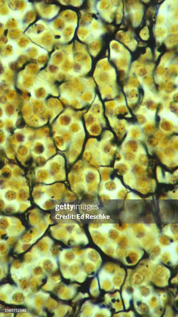Connective Tissue--RETICULAR CONNECTIVE TISSUE, Spleen, 250X