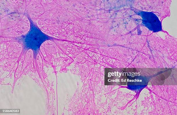 motor neurons (multipolar) with many processes 50x - cell biology stock pictures, royalty-free photos & images