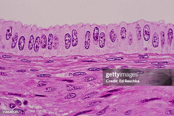 simple columnar epithelium, uterus, human--250x - uterus line stock pictures, royalty-free photos & images