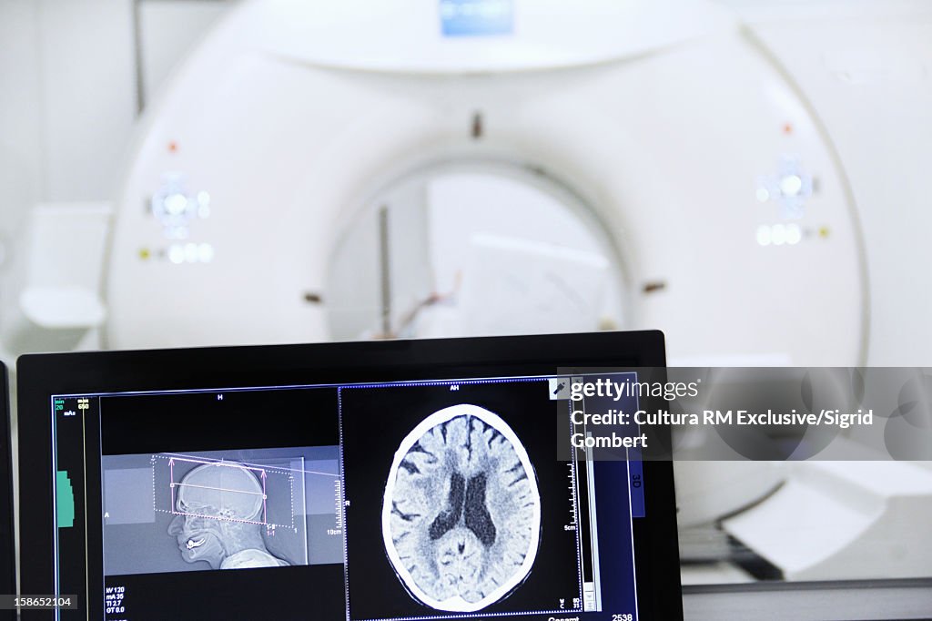Brain scans in lab