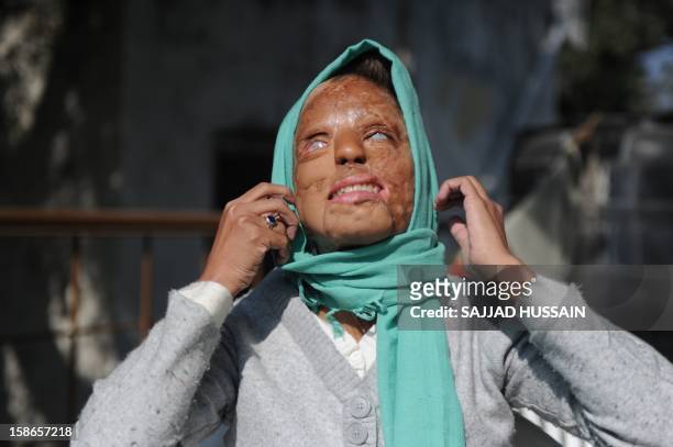 India-women-crime-entertainment,FEATURE by Rupam Jain Nair In a picture taken on December 6 Indian acid attack survivor Sonali Mukherjee adjusts her...