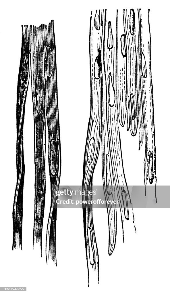 Medizinische Illustration menschlicher glatter Muskelfasern - 19. Jahrhundert