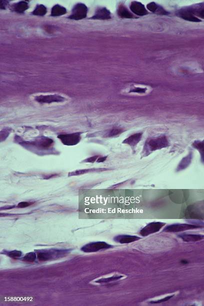developing spongy bone, osteoblasts and osteocytes - spongy bone stock pictures, royalty-free photos & images