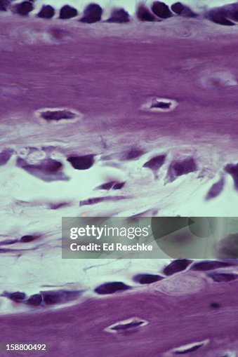 Developing Spongy Bone, Osteoblasts and Osteocytes Developing Spongy Bone, Osteoblasts and Osteocytes
