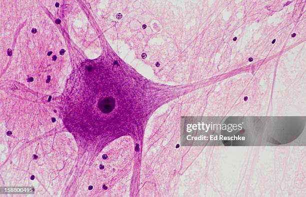 multipolar motor neuron, cell body, dendrites,axon - célula humana imagens e fotografias de stock