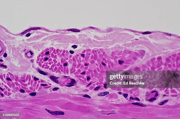 mesothelium, visceral peritoneum and serosal layer - membrana serosa fotografías e imágenes de stock