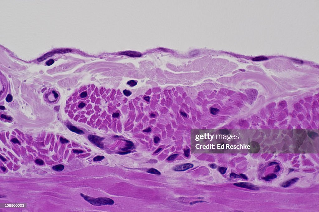 Mesothelium, Visceral Peritoneum and Serosal layer
