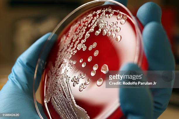 bacterial growth (staphylococcus aureus) on blood - stafylokokken stockfoto's en -beelden