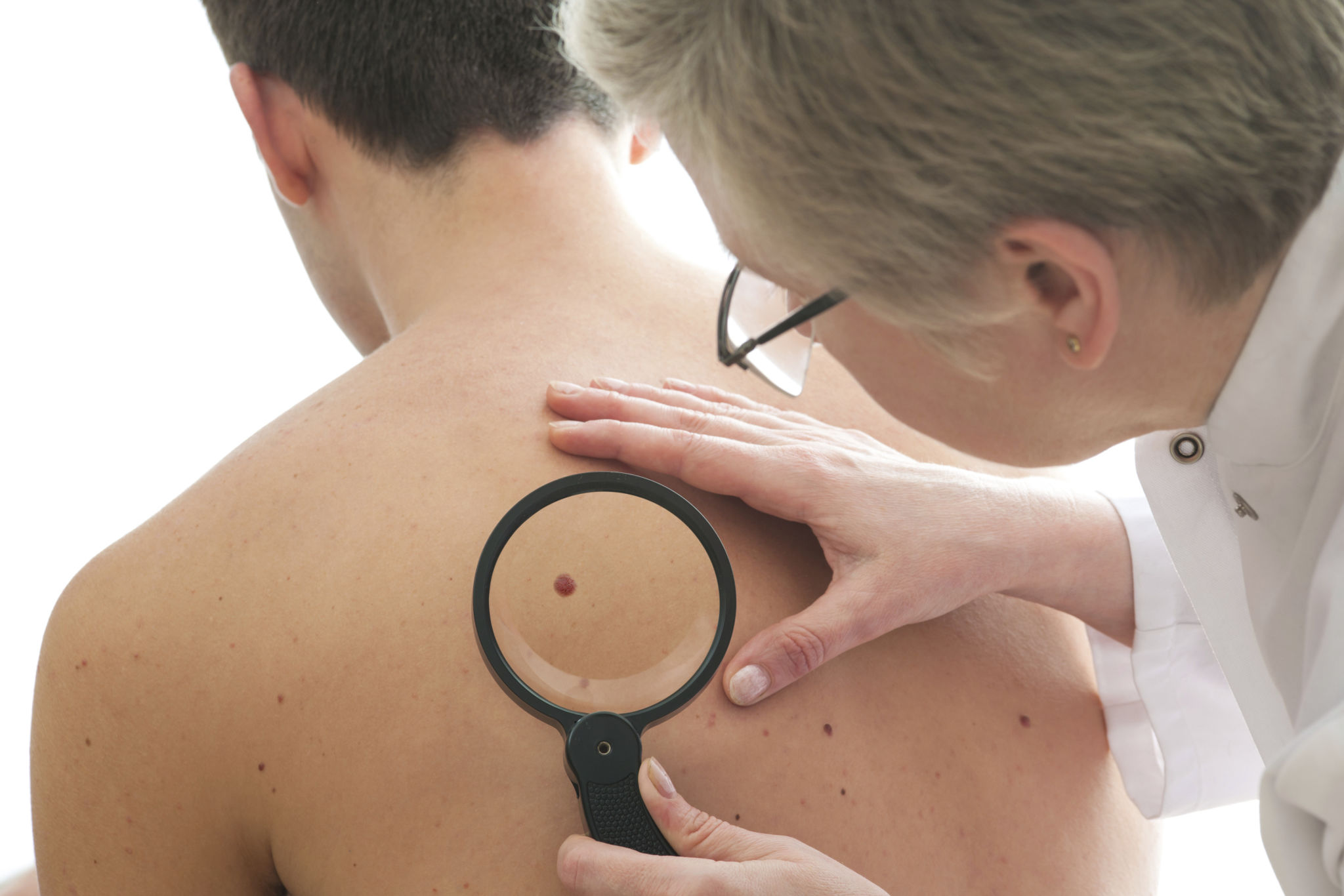 skin type test
