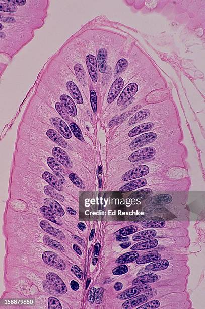 simple columnar epithelium with goblet cells, 100x - epitelio fotografías e imágenes de stock