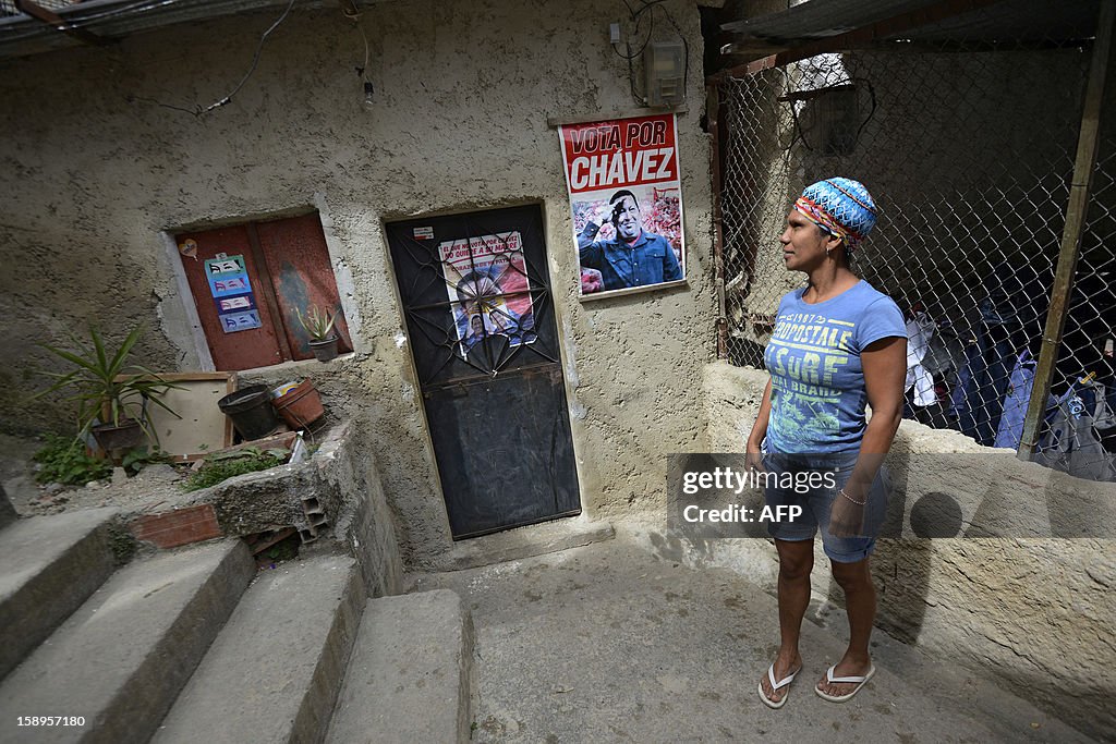 VENEZUELA-HUGO CHAVEZ-HEALTH