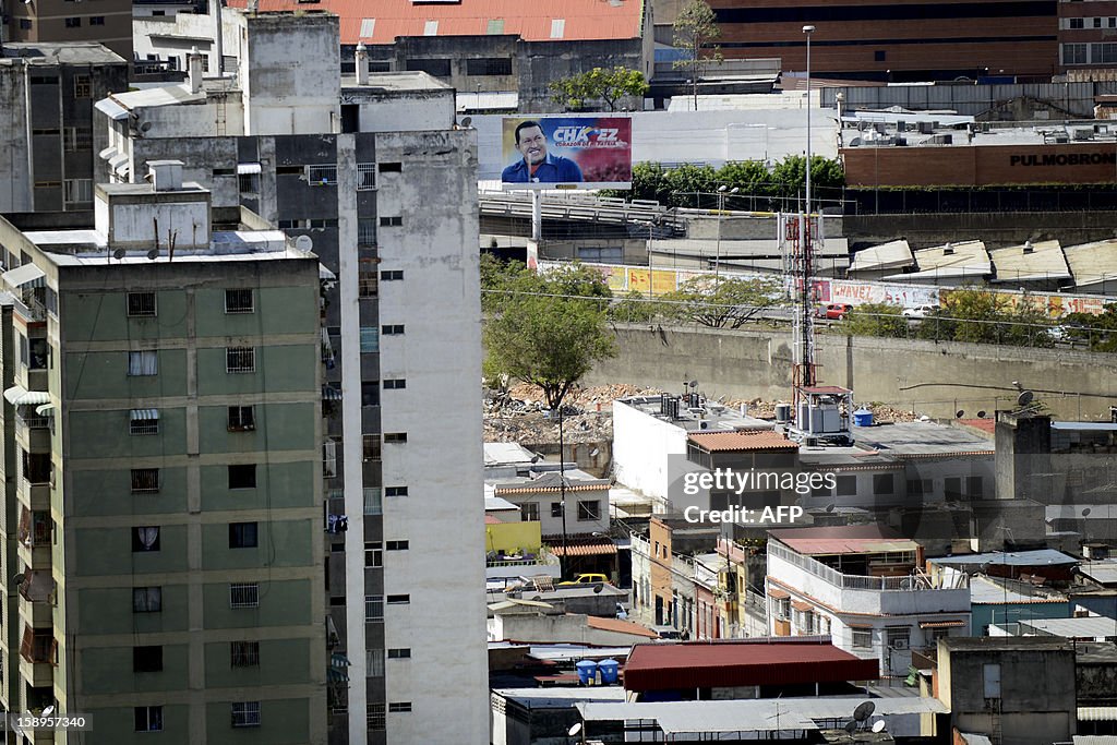 VENEZUELA-HUGO CHAVEZ-HEALTH