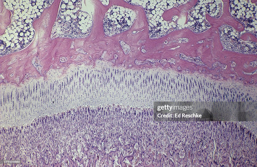 Growing Bone with Epiphyseal Disk (Growth Plate)