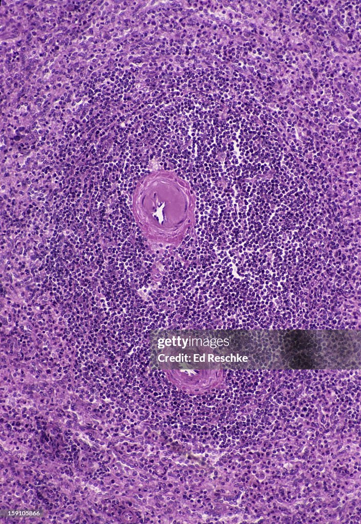 Spleen (Human) with White Pulp and Red Pulp, 50X