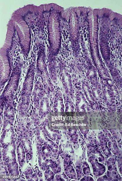 stomach, gastric glands, parietal  and chief cells - slijmvlies colon stockfoto's en -beelden