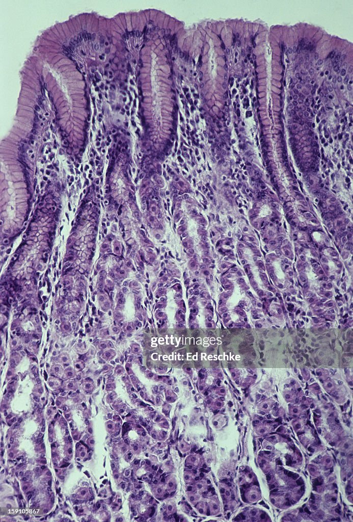 Stomach, Gastric Glands, Parietal and Chief Cells