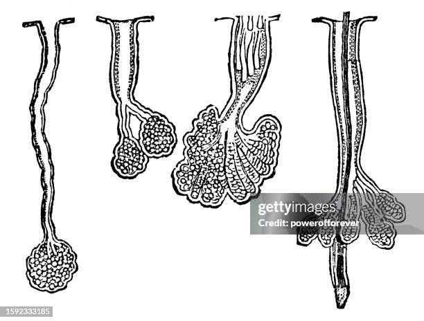 ilustraciones, imágenes clip art, dibujos animados e iconos de stock de ilustración médica de glándulas sebáceas humanas del cuero cabelludo y la nariz - siglo 19 - acné