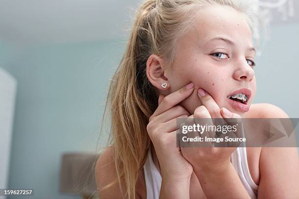 teenage girl squeezing a spot - acnes stock pictures, royalty-free photos & images