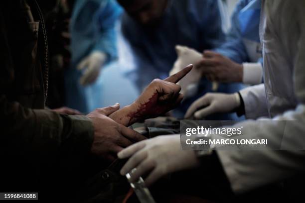 Wounded fighter points as he is wheeled into a the Ras Lanuf hospital from the battle in Bin Jawad on March 6, 2011 as tanks shell the centre of...