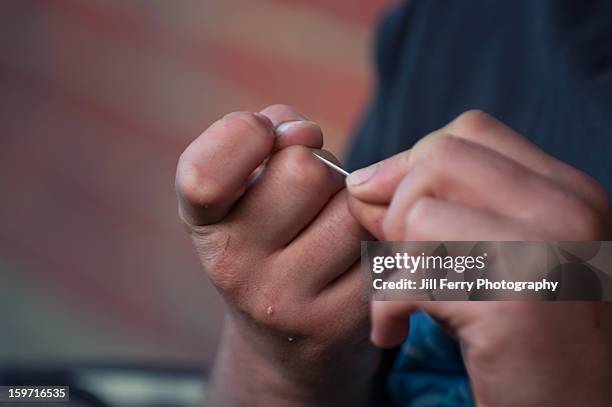 Metal Splinter In Finger 68 Splinter Finger Stock Photos, High-Res Pictures, and Images - Getty ...