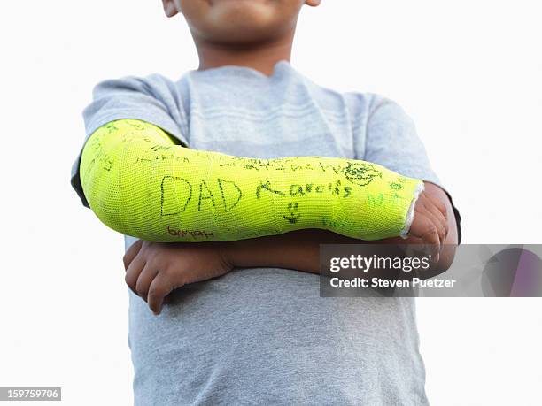 boy with broken arm in yellow cast - armbruch stock-fotos und bilder
