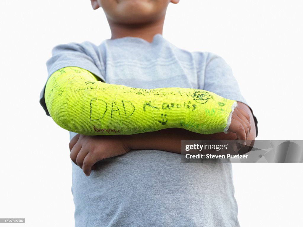 Boy with broken arm in yellow cast