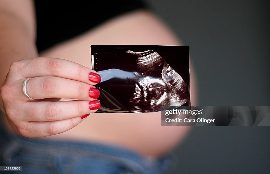 Maternity/ultrasound/baby girl