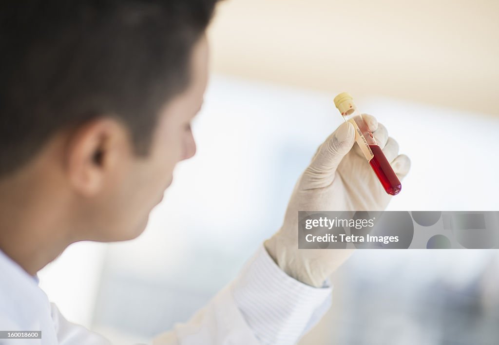 Technician holding blood sample