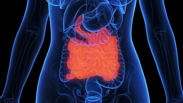 Inflamd 484 Inflamed Intestine Stock Videos, Footage, & 4K Video Clips - Getty ...