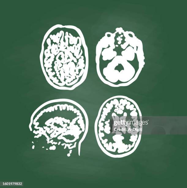 Brain Scan Edrawing 259 X Ray Machine Drawing High Res Illustrations - Getty Images