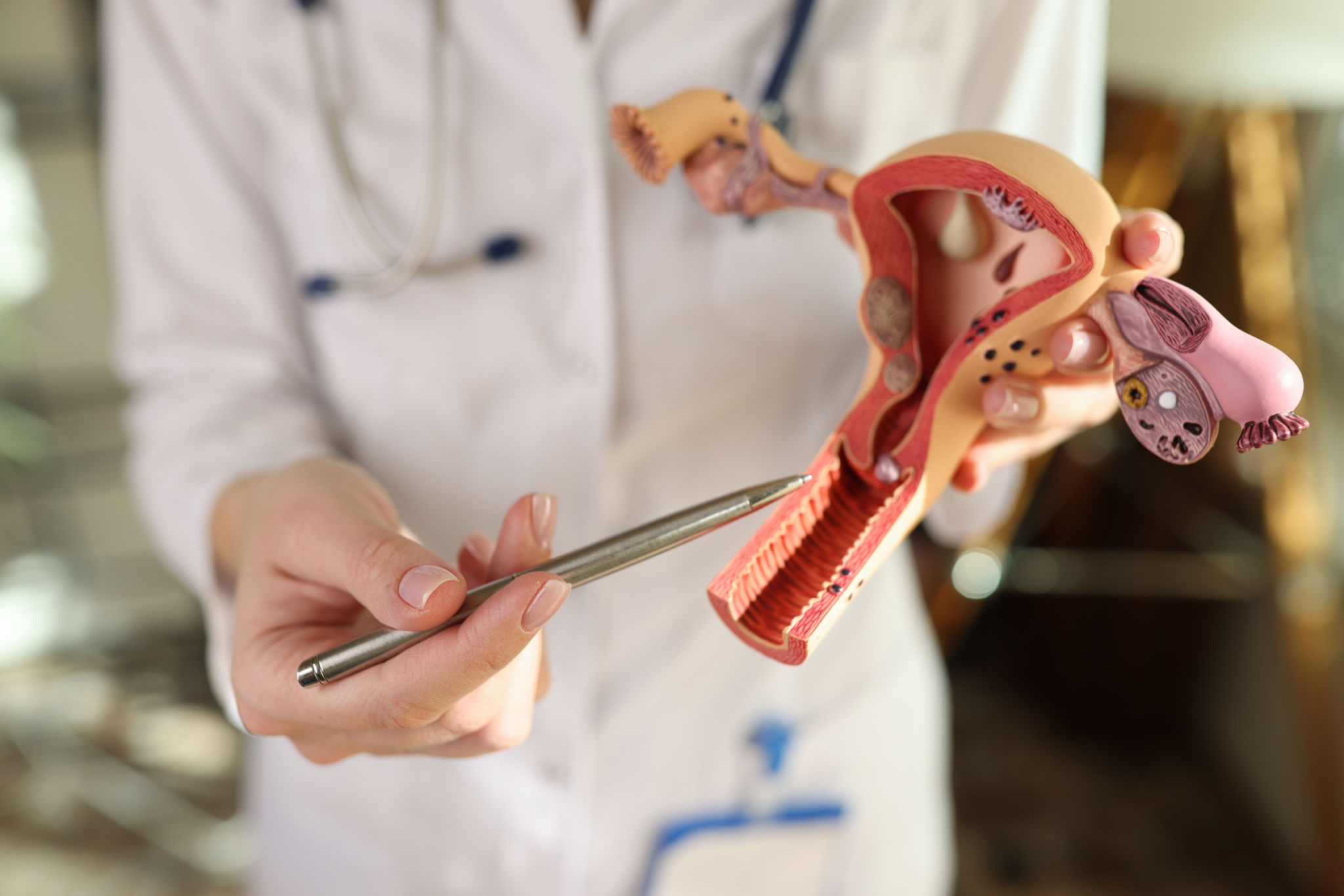 Doctor gynecologist explaining how female genital organs are arranged on artificial uterus model closeup Doctor gynecologist explaining how female genital organs are arranged on artificial uterus model closeup