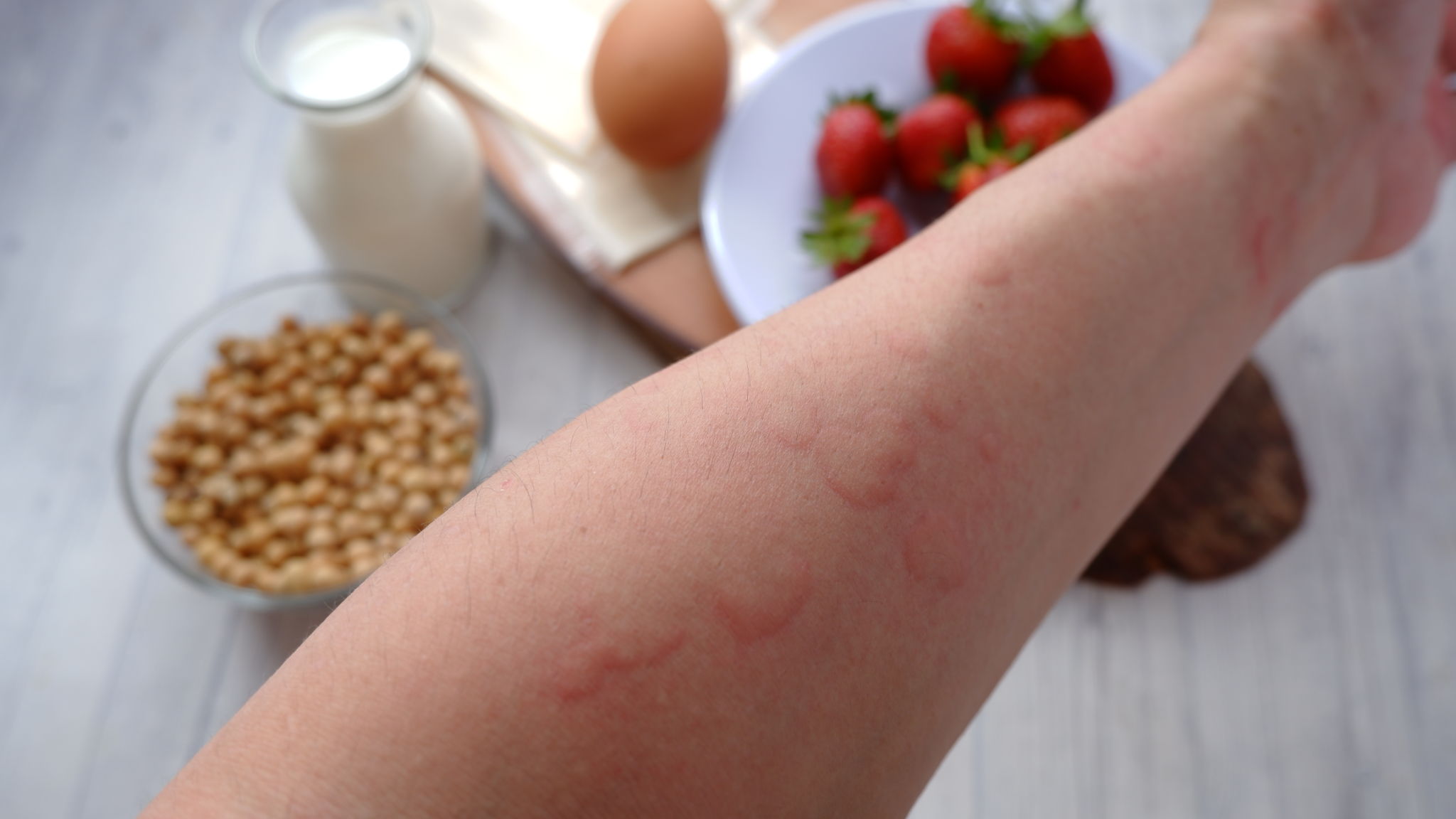allergy triggers