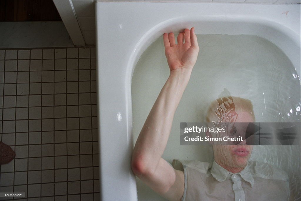 Shaun D. Ross, an albino model