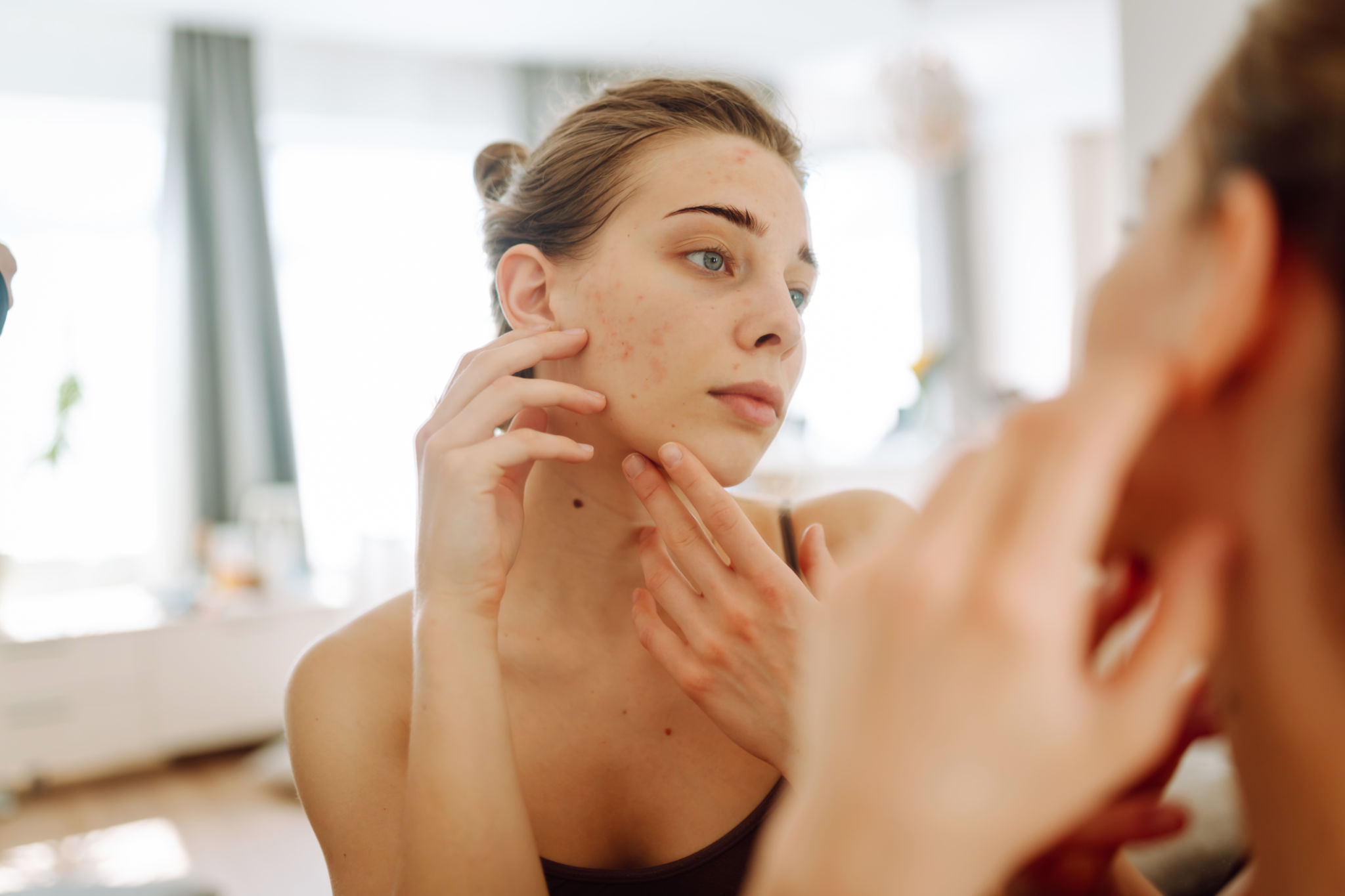 skin concerns