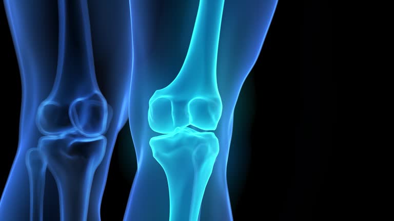 Tibia Animation 83 Tibia Fibula Anatomy Stock Videos, Footage, & 4K Video Clips - Getty ...
