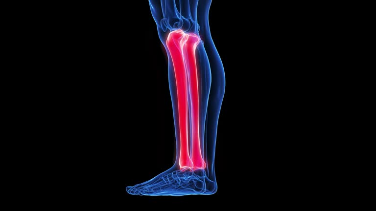 Tibia Invisibility 100 Tibia Anatomy Stock Videos, Footage, & 4K Video Clips - Getty Images