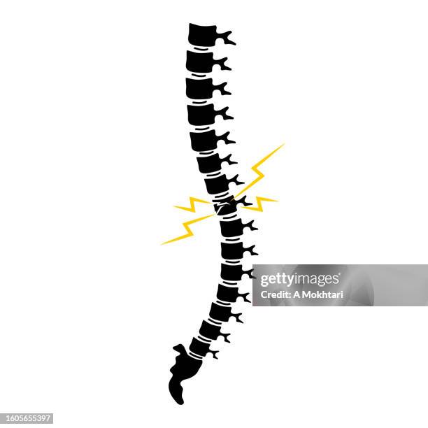 stockillustraties, clipart, cartoons en iconen met vertical spine pain. - osteoporose