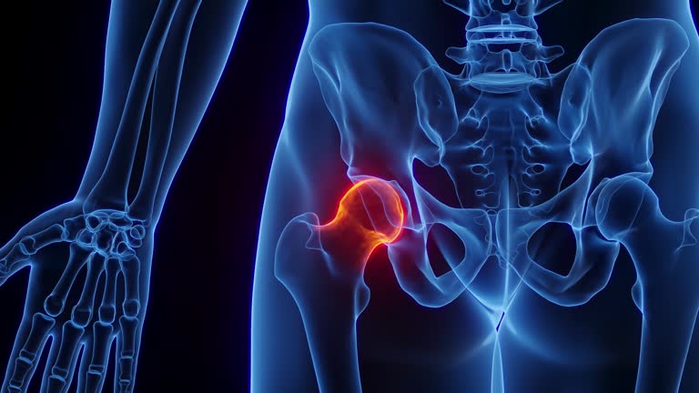 Left Hip Hip Joint Anatomy Videos and HD Footage - Getty Images