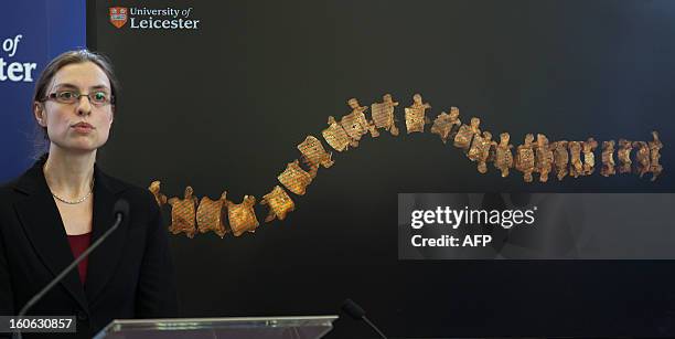 Dr Jo Appleby, a lecturer in bioarchaeology at Leicester University, addresses a press conference in front of an image showing the abnormal curvature...