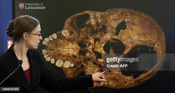 Dr Jo Appleby, a lecturer in bioarchaeology at Leicester University, points to an image of the skull of Britain's King Richard III, during a press...
