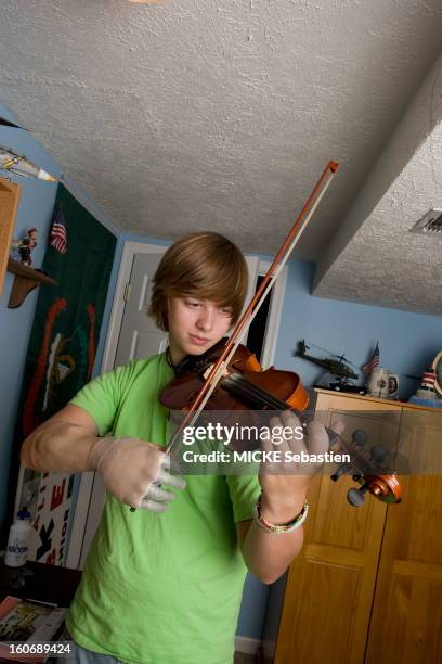 Michael Waldron, a young man of 18 years living in Glen Burnie , was born with only one inch from the right side. Thanks to the British company Touch...