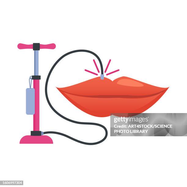 lip augmentation, conceptual illustration - cosmetics stock illustrations