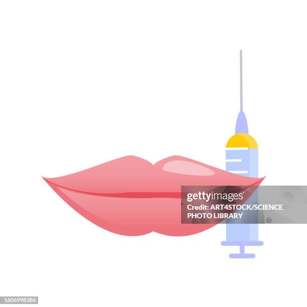 lip augmentation, illustration - beauty products stock illustrations