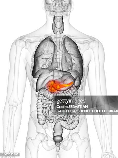 ilustrações de stock, clip art, desenhos animados e ícones de pancreas cancer, illustration - cancro-do-pâncreas