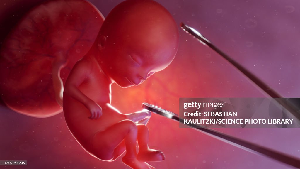 Abortion, conceptual illustration