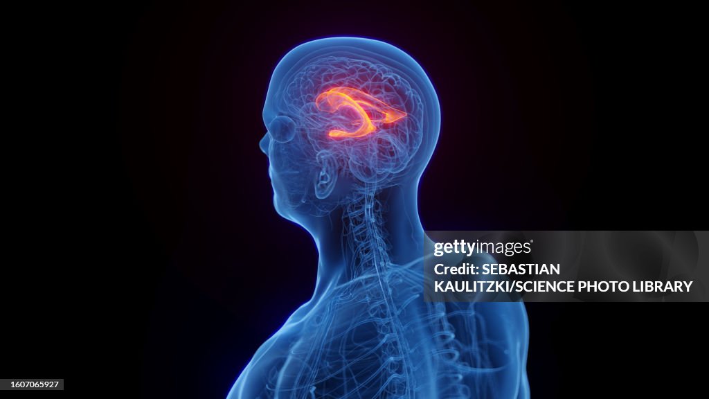 Lateral ventricle, illustration