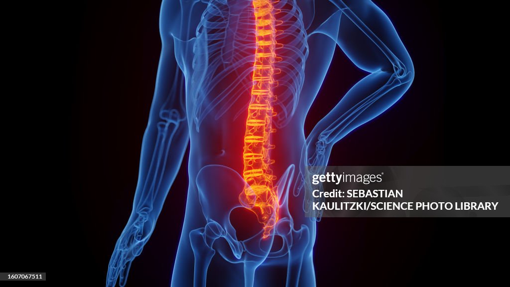 Bckche Backache Illustration High-Res Vector Graphic - Getty Images
