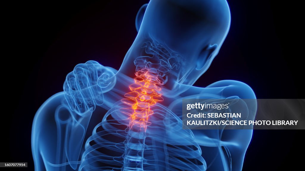 Neck pain, illustration