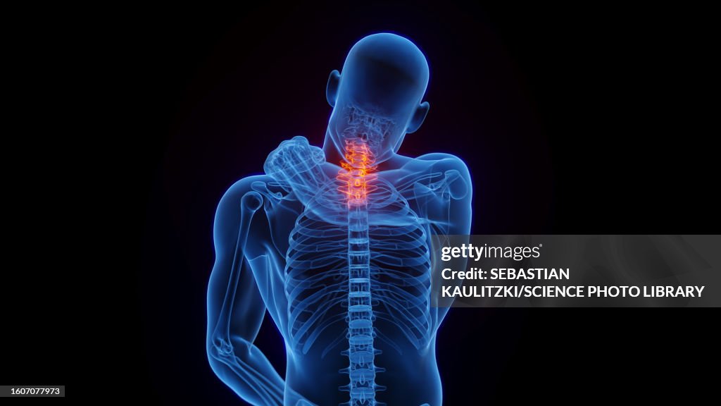 Neck pain, illustration